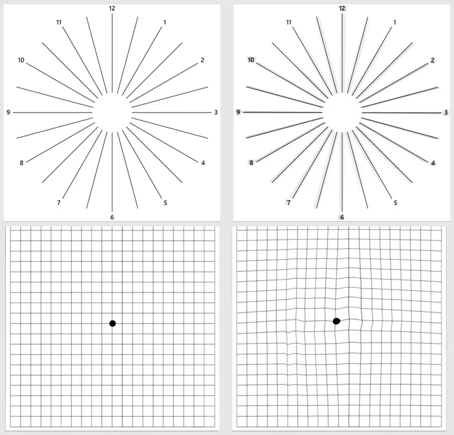 Eye-Q Check